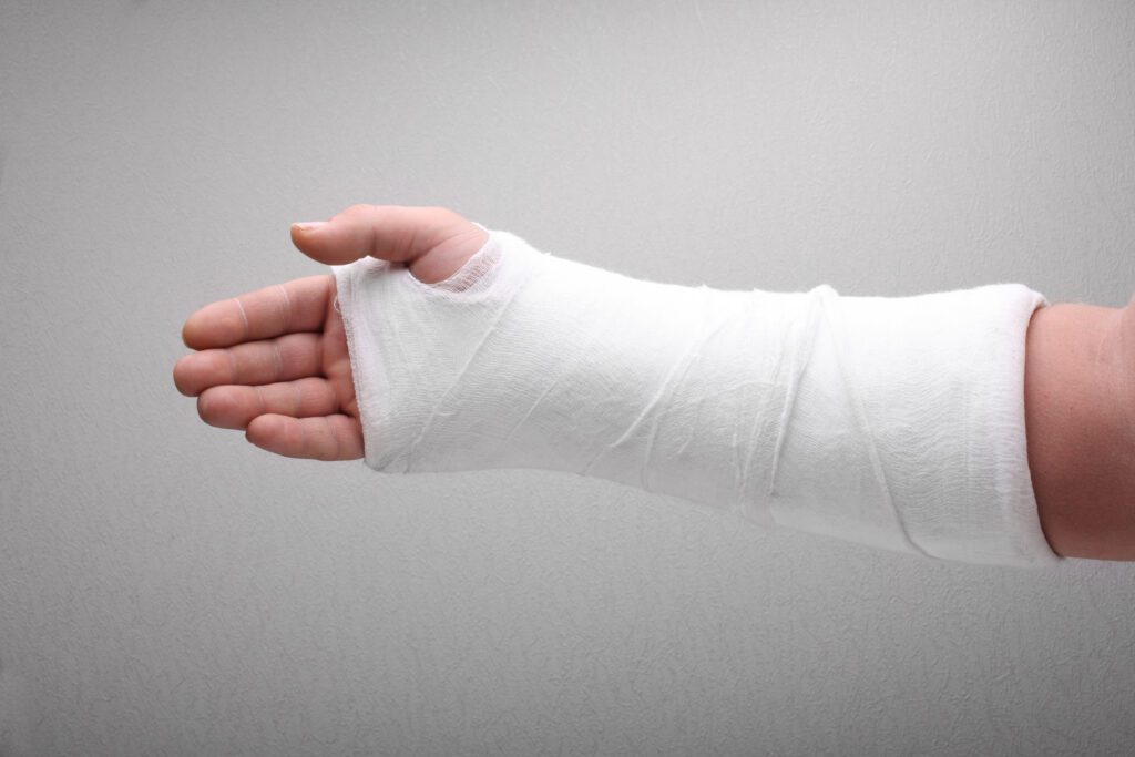 Plâtre, immobilisation pour survivalistes et randonneurs