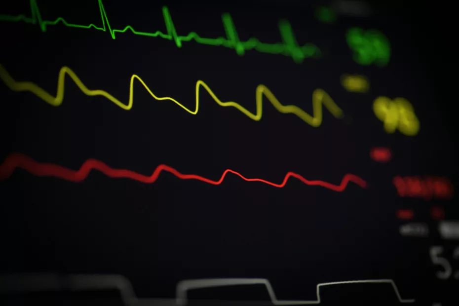 Rythme cardiaque sur scope